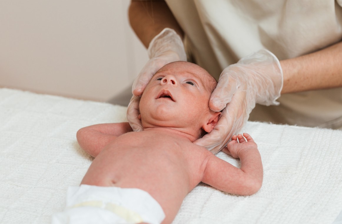 Bebê em tratamento para plagiocefalia