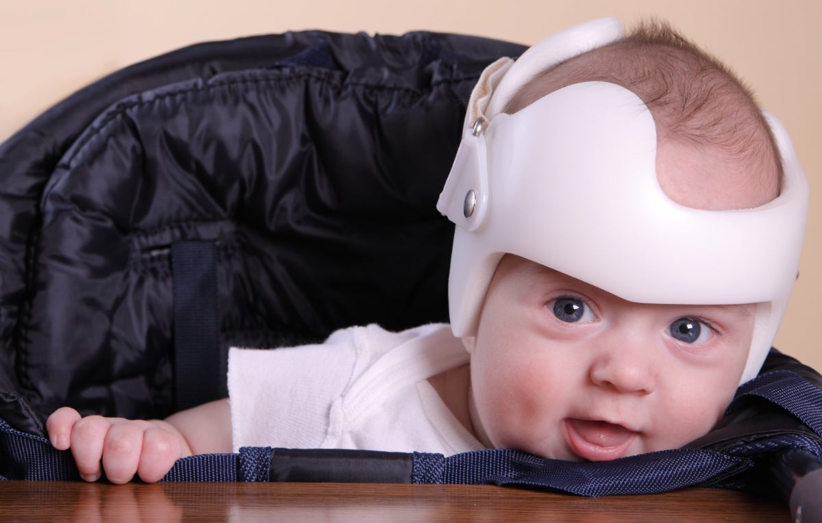 Bebê sentado na cadeirinha com capacete para plagiocefalia